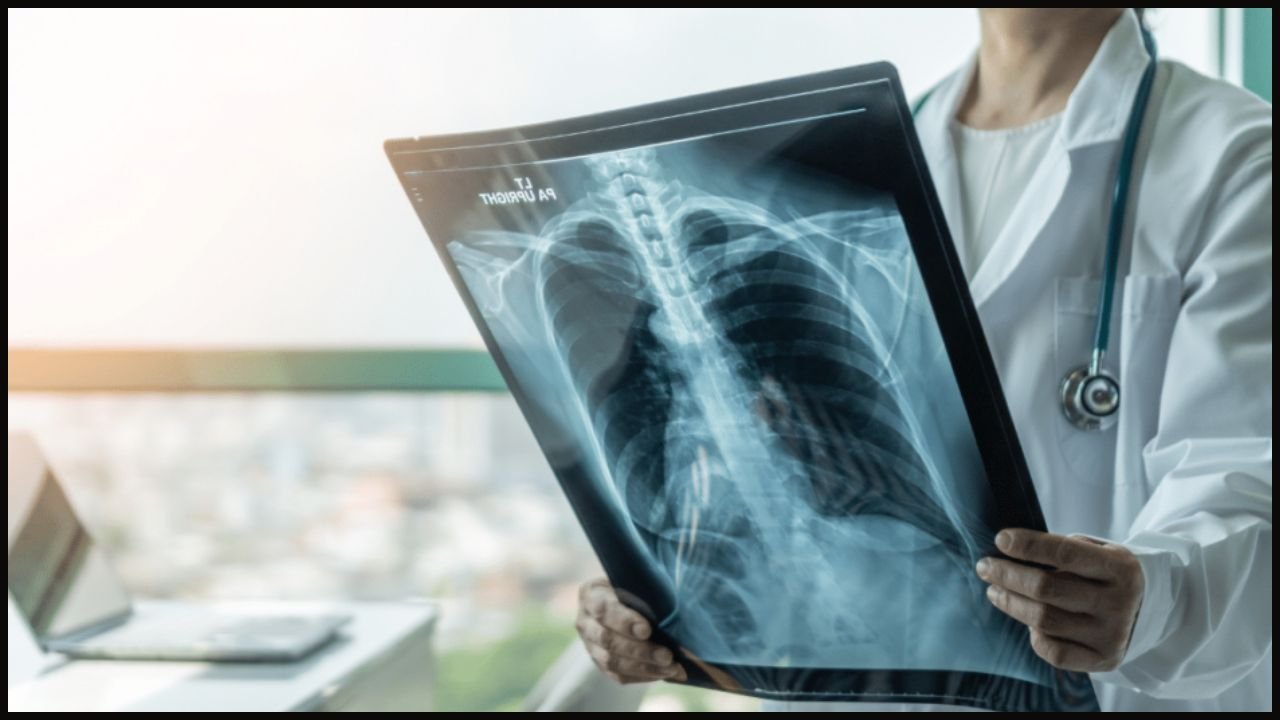 Haryana News: सिर्फ 5 मिनट में एक्स-रे, फतेहाबाद अस्पताल में नई हाईटेक मशीन, जानें कैसे मरीजों को मिलेगा फायदा